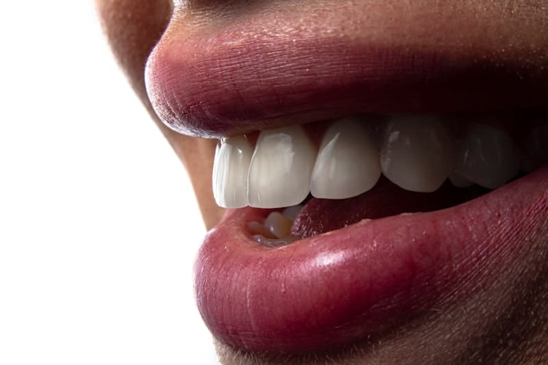 Impianti Dentali